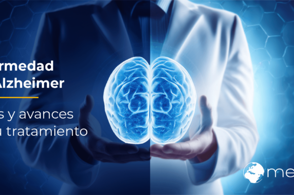 Enfermedad de Alzheimer: Retos y avances en su tratamiento