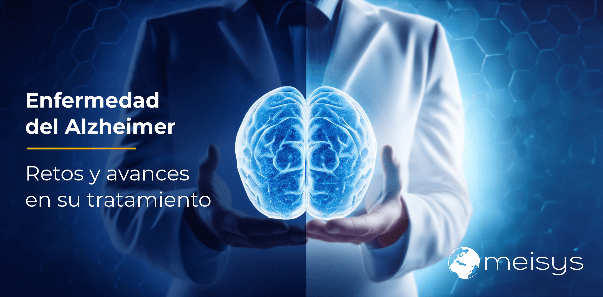 Enfermedad de Alzheimer: Retos y avances en su tratamiento